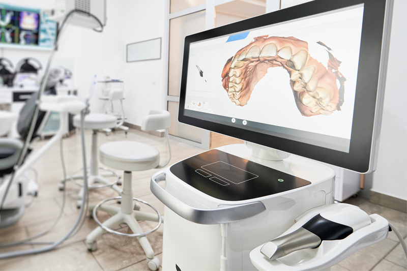 Intra-Oral Scanner in Livonia